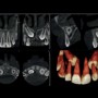 Obrázok : Zubný 2D + 3D röntgen - DENTINIKA