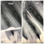 Fotografia ambulancie