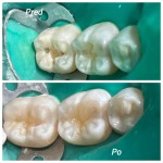 Fotografia ambulancie