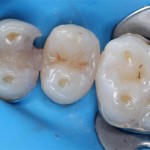 Fotografia ambulancie