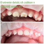 Fotografia ambulancie