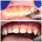 Fotografia ambulancie